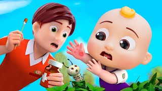 Ouchie Ouch Song  Boo Boo CoComelon Toys Nursery Rhymes amp Kids Songs [upl. by Auqinet560]