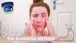 I Tried SLUGGING For A Week With ACNE Prone Skin [upl. by Ludovick532]