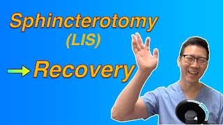 LIS fissure surgery How long is the recovery [upl. by Schear]