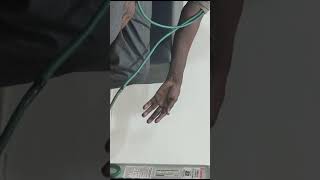 Trousseau sign demonstration in hypocalcaemia [upl. by Luhar522]