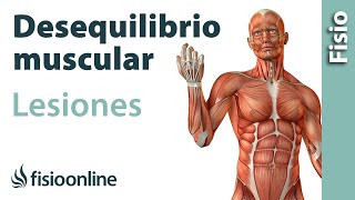 Causas de las lesiones musculares y tendinosas  Desequilibrio muscular vencedorvencido [upl. by Brady]