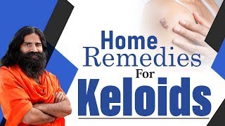 Home Remedies For Keloids  Swami Ramdev [upl. by Farrish160]