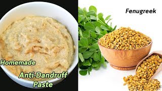 How to Get Rid of Dandruff  Homemade Natural Treatment  Miracle Cure For Dandruff [upl. by Hort]