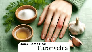 Get Rid of Painful Paronychia Naturally Home Remedies [upl. by Cardie]