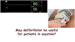 May defibrillator be useful for patients in asystole [upl. by Llenroc]