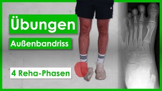 Bänderriss im Sprunggelenk⎮4 PhasenAnleitung⎮Übungen [upl. by Okier]