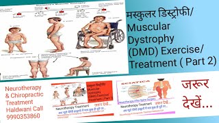 मस्कुलर डिस्ट्रोफी पार्ट 2 DMD ExerciseTreatment Part 2 Neurotherapy Chiropractic Treatment HLD [upl. by Troy524]