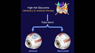 AVB  Ahmed vs Baerveldt Study [upl. by Aidnama529]