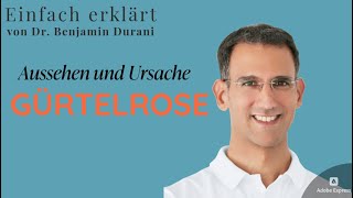 Gürtelrose  Aussehen und Ursachen  Einfach erklärt von Dr Durani Facharzt für Hautkrankheiten [upl. by Eniad]