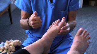 Spread Your Toes™ Series Hallux Limitus Conservative Care vs Conventional Care [upl. by Antonius]