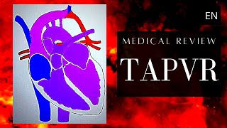 Total Anomalous Pulmonary Venous Return TAPVR  TAPVC Congenital Heart Disease [upl. by Lisle]