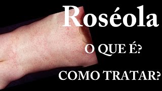 Roséola  O que é  Sintomas  Tratamento [upl. by Silverts871]