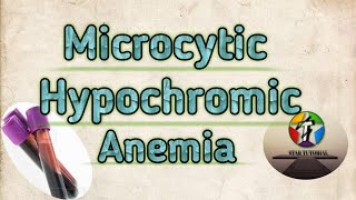 Microcytic Hypochromic Anemia in hindi ll ANEMIA ll Hematology And Blood Banking [upl. by Linzer]