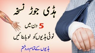 Instant Bone Fracture Treatment In Urdu  Joron ka Dard  Bone Fracture Repair In UrduHindi [upl. by Ttnerb]