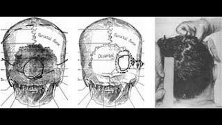 Carl Oglesby The Medical Evidence in the JFK Assassination 1992 [upl. by Hummel309]