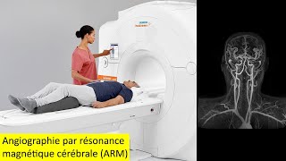 Angiographie par résonance magnétique cérébrale ARM [upl. by Jr]