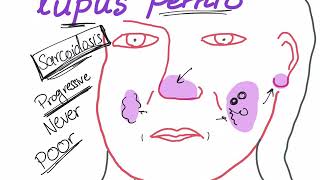 Lupus Pernio with a mnemonic [upl. by Siva]