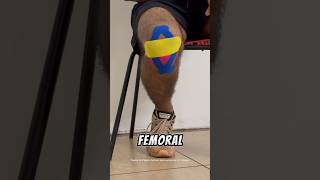 Effective Taping Strategies for Patellofemoral Pain Relief physiotherapy [upl. by Nomelihp]