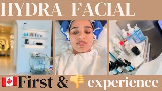 Experts recommend a HydraFacial in Canada for glowing skin [upl. by Orelia]