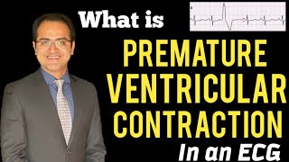 Premature Ventricular ContractionComplex PVC ECG Explained Treatment ECG Lectures USMLENCLEX [upl. by Yank]