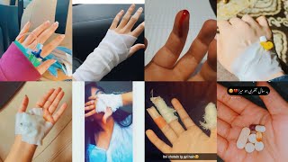 😳🤕🤧 Accident dp ideas😹2023 hand bandage 🤕 dp for boys and girlshand dpcannula hand dp photo🤞 [upl. by Lorre]