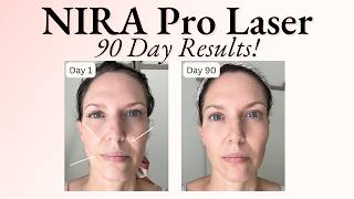 90 Day Results Using NIRA Pro Laser  Before amp After Photos  Fine Lines Wrinkles amp Build Collagen [upl. by Michel]