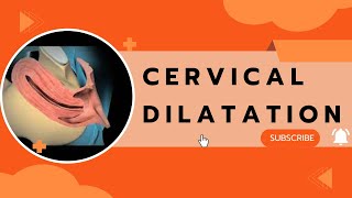 Cervical Dilatation [upl. by Harshman]