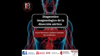 Diagnóstico imagenológico de la disección aórtica [upl. by Greerson]