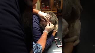 Steves Face again More huge gross Cyst popping zit gross action [upl. by Elyrad]