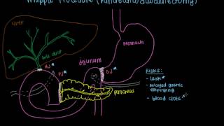 Whipple Procedure Pancreaticoduodenectomy [upl. by Manoff]