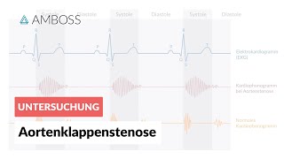 Aortenklappenstenose  Herzgeräusch  AMBOSS Video [upl. by Brunelle]