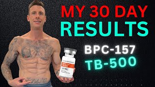 My Incredible Results BPC157TB500 Peptides  Inflammation Wound Healing Injection [upl. by Elnar743]