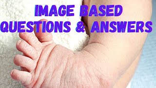 Image Based Questions  Child Health Nursing  Important Questions  Answers [upl. by Aneert547]