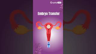 IVF Procedure Stepbystep  Crysta IVF ivf ivfjourney embryotransfer embryotransferprocedure [upl. by Yelra]