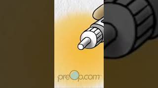 🔍 Insulin Pen Use Explained PreOp shorts Diabetes  PreOp® Patient Education Pt 3 [upl. by Brita]