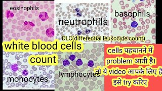 blood test differencial leukocytes count  DLC count sabse sahi tarika I dlc count in microscope [upl. by Assiluy646]