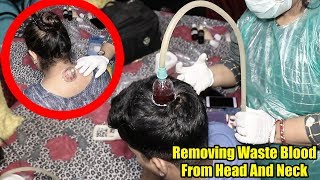 The Best And Easy Way To SOLVE ALL SKIN PROBLEM  Hijama CuppingThearpy [upl. by Anaek]