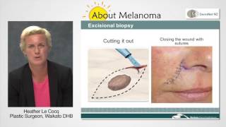 How Is Melanoma Removed [upl. by Nosloc]