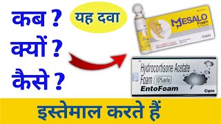 ulcerative colitis क्या होता है उससे बचने के लिए इनका कैसे करें इस्तेमाल।। mesalo foam how to use [upl. by Lune]