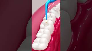 AsMR animation dental care asmr asmranimation satisfying animation cartoon [upl. by Beare474]