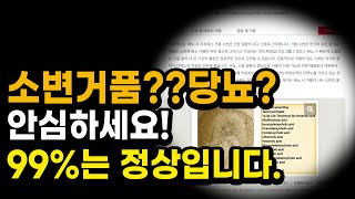 거품뇨와 단백뇨 생기는 이유 와 치료방법은  정상적인 거품뇨와 병이 있는 거품뇨 구분방법  거품뇨  단백뇨  당뇨 신장 신장병 신장이상 콩팥 콩팥병 콩팥이상 [upl. by Chloe]