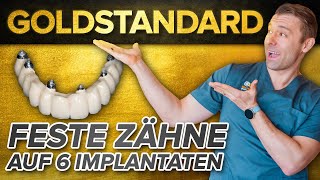 Feste Zähne auf 6 Implantaten  Der Goldstandard in der Implantologie [upl. by Susan]