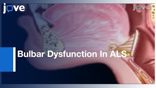 Comprehensive Assessment Bulbar Dysfunction In Amyotrophic Lateral Sclerosis l Protocol Preview [upl. by Inahpit]