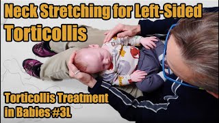 3L Neck Stretches for Leftsided Torticollis Torticollis Treatment in Babies [upl. by Ycrem]