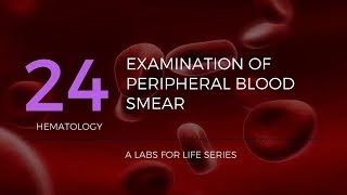 Part 2  Examination of Peripheral Blood Smear [upl. by Ledeen]