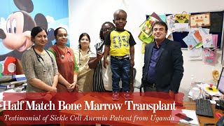 Half match Bone Marrow Transplant  Haploidentical  Sickle Cell Anemia Patient from Uganda [upl. by Eisus]