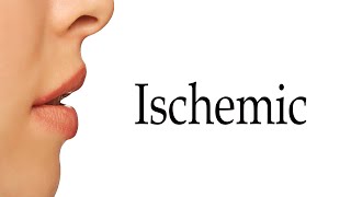 How To Say Ischemic [upl. by Wally379]