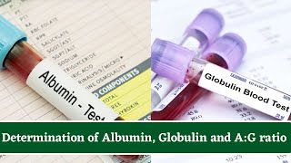 Determination Of Albumin and Globulin Total Protein Test And AlbuminGlobulin AG Ratio [upl. by Negriv]