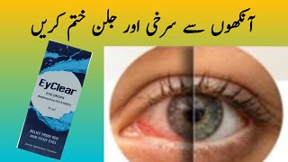 How to remove eye irritation  How to get rid of eye pain and redness  Naveedshaheen01 [upl. by Shiff]