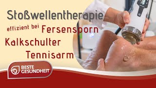 Stoßwellentherapie Effektive Behandlung bei Kalkschulter Fersensporn Tennisarm amp Co [upl. by Aicelav]